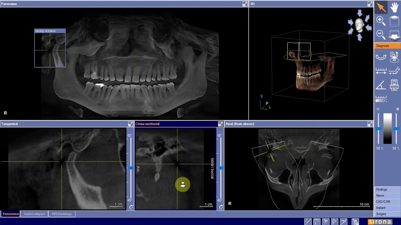 CBCT Basic Image Planes