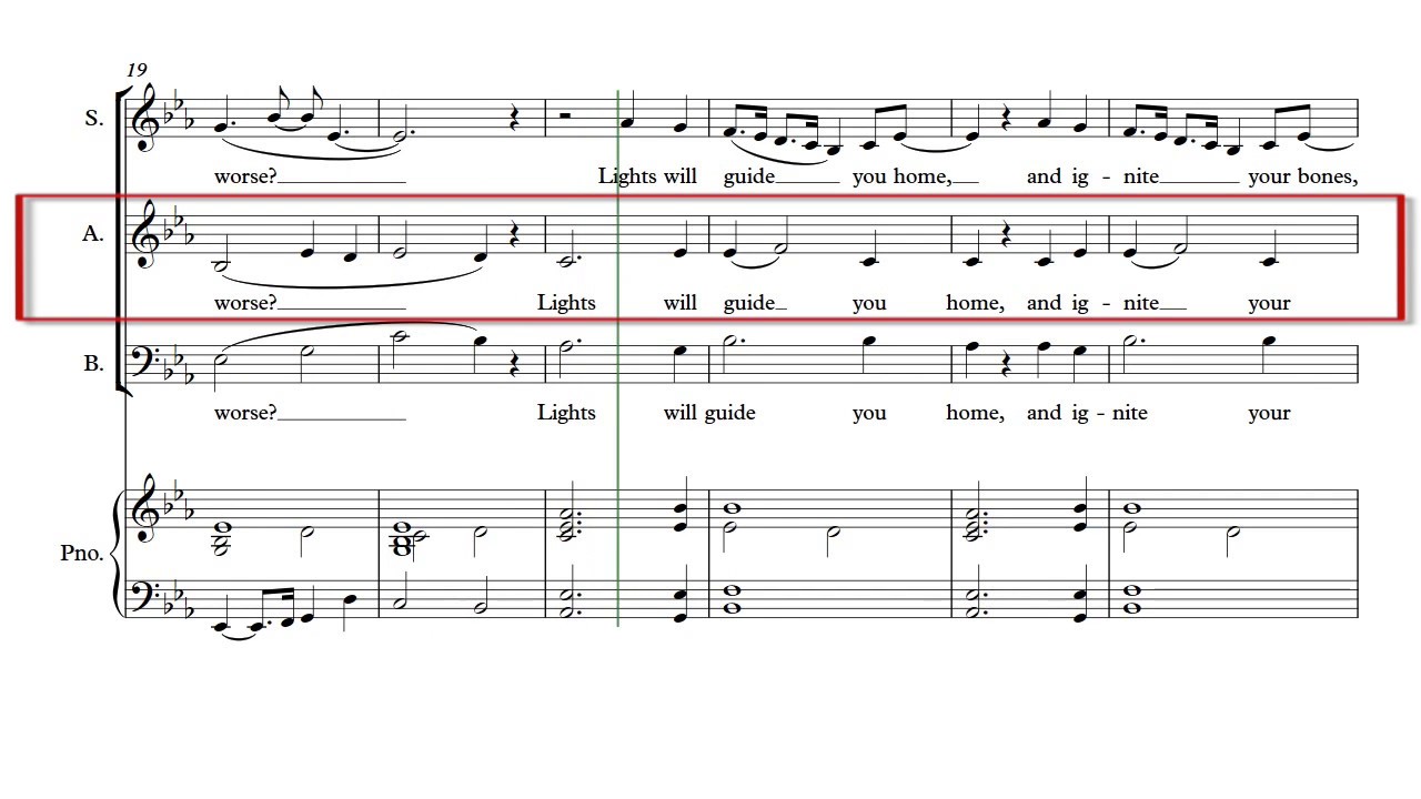 Fix You Alto