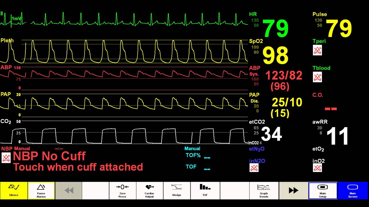Simulated Patient Monitor