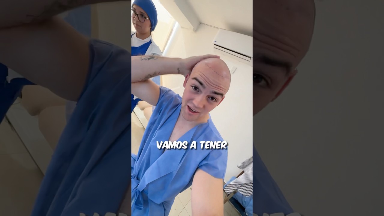 ME OPER&Eacute; y ahora soy CALVO?! 😳🥵😭🫣😱