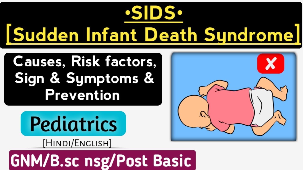 SIDS (Sudden Infant Death Syndrome) || Child health nursing || Lecture in hindi