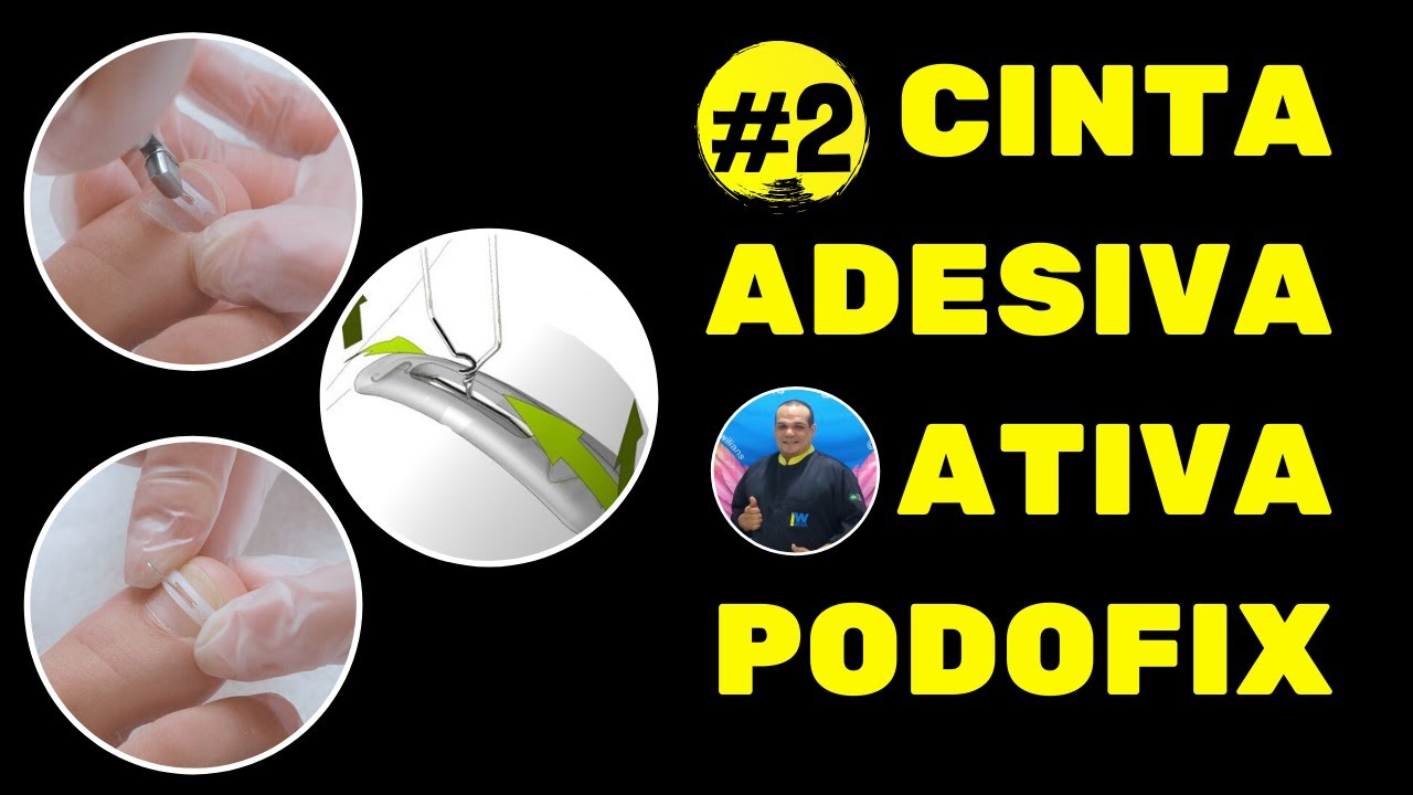 PODOFIX (PARTE 2)