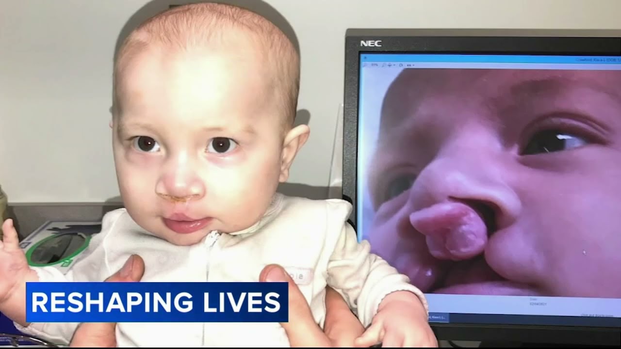 Surgeon at Nemours Children's Hospital shares personal, professional journey with cleft lip