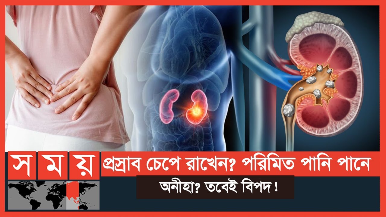 কিডনিতে পাথর: কারণ ও চিকিৎসা | Kidney Stone | বদ্যি বাড়ি | Boddi Bari | Somoy TV