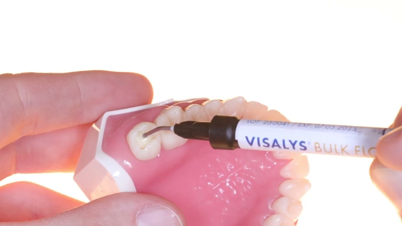 Fill or Flow? Consistency Test: Visalys® Bulk Flow feat. Dr. Dobbertin