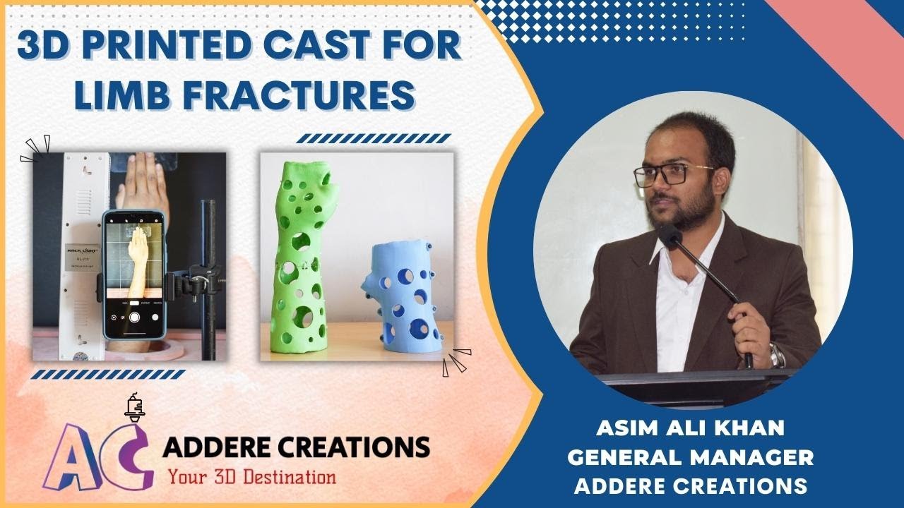 3D Cast for Limb Fractures | Addere Creations