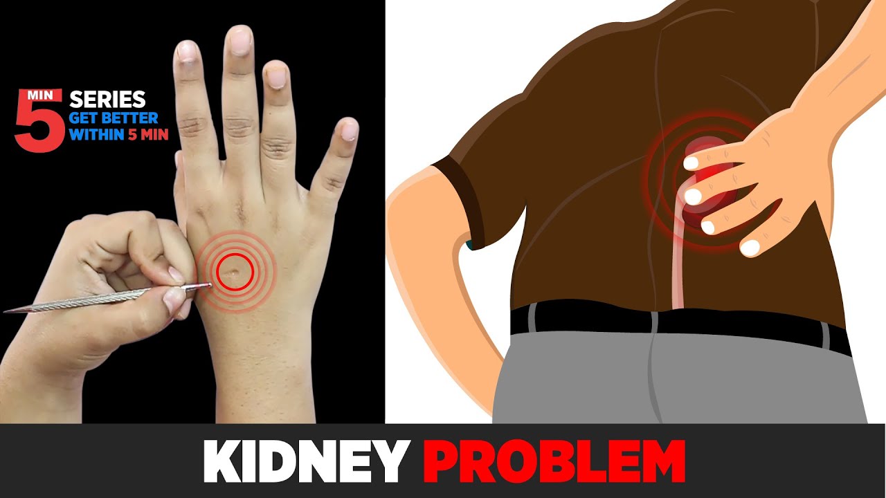 Sujok Treatment for Kidney Problems,😖🔥 Kidney stones, Kidney Failure, nephrotic syndrome.