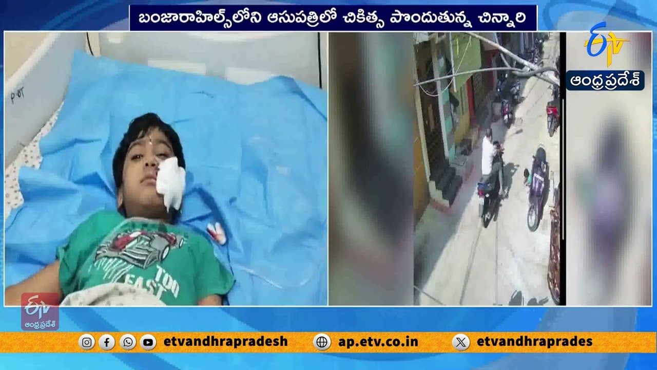 ఖైరతాబాద్‌లో చిన్నారిపై కుక్క దాడి | Stray Dog Attack Leaves Child Injured | Hyderabad