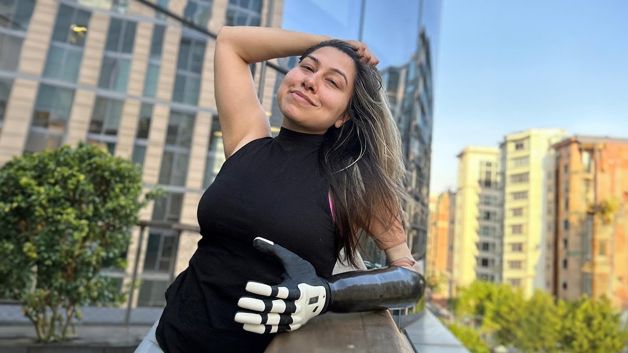 The COVVI Hand | An Overview Of Our World-Leading Prosthetic Hand
