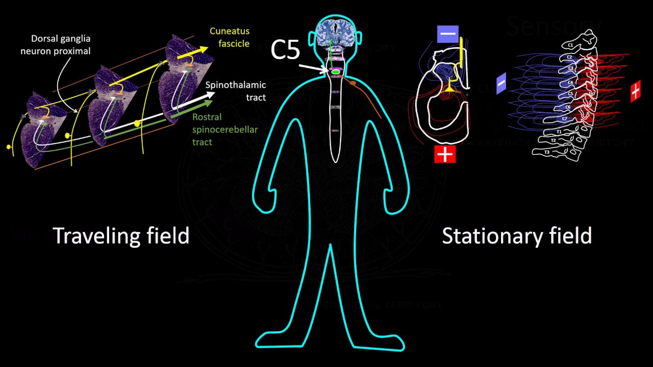 Intraoperative monitoring (SSEP). Part 2