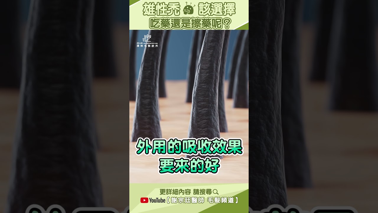 雄性禿，該選擇吃藥還是擦藥呢？