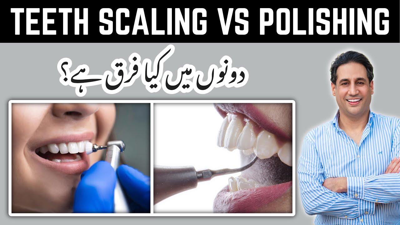 Difference Between Teeth Scaling and Polishing | Dental Cleaning | Best Dentist in Pakistan