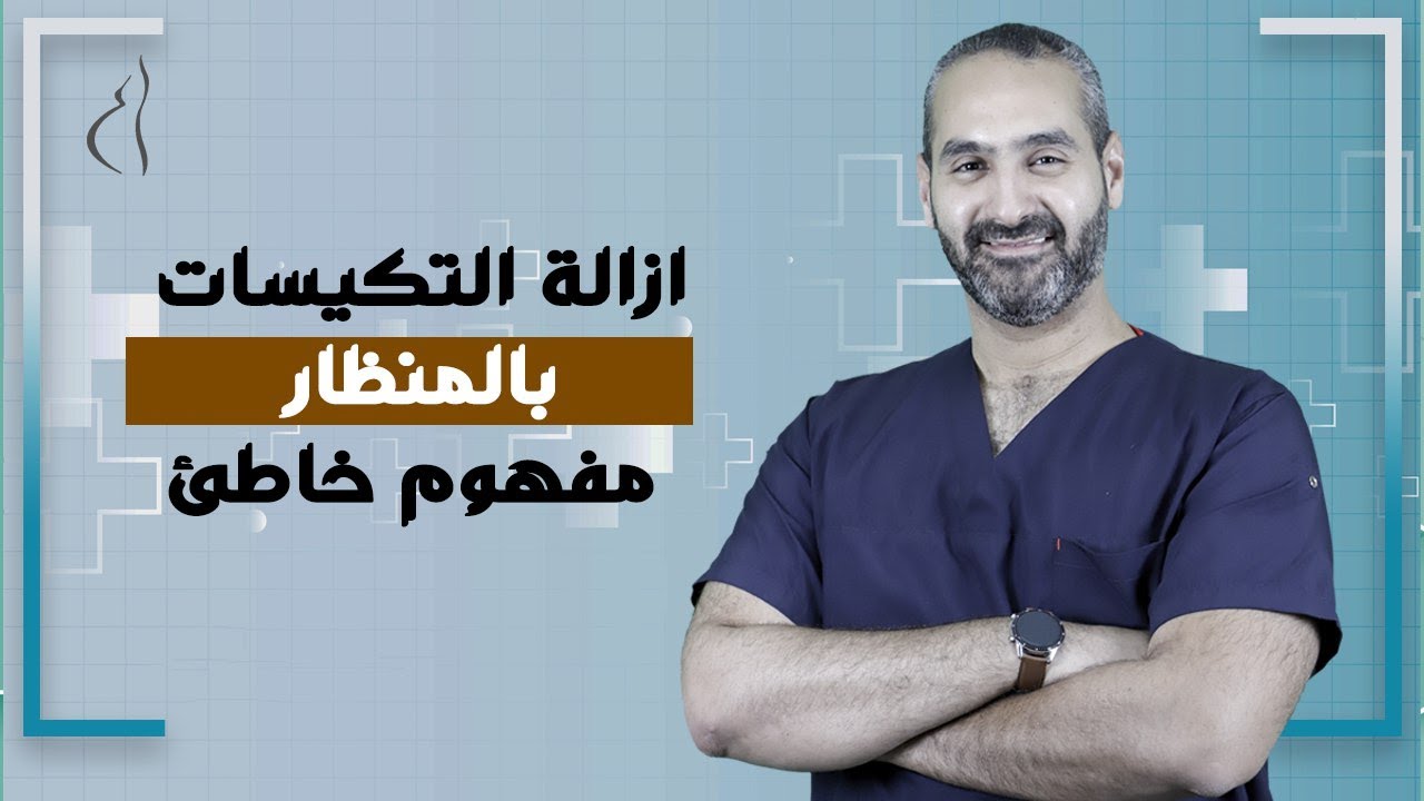 ازالة التكيسات بالمنظار مفهوم خاطئ