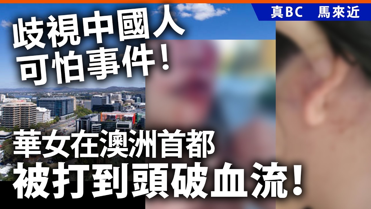 歧視中國人可怕事件！華女在澳洲首都被打到頭破血流！