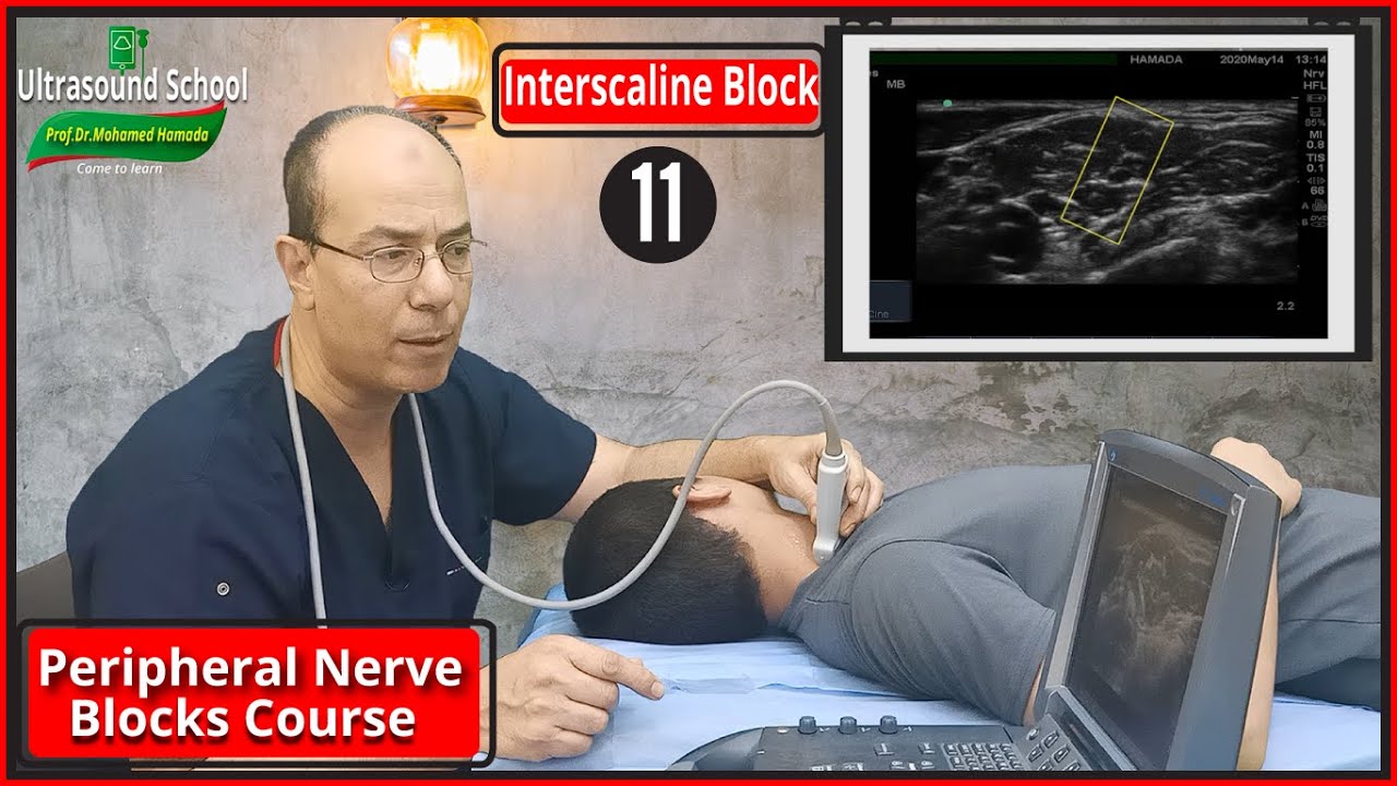 Interscaline Block)Ultrasound Guided peripheral Nerve Blocks Course |Mohamed Hamada|(11)