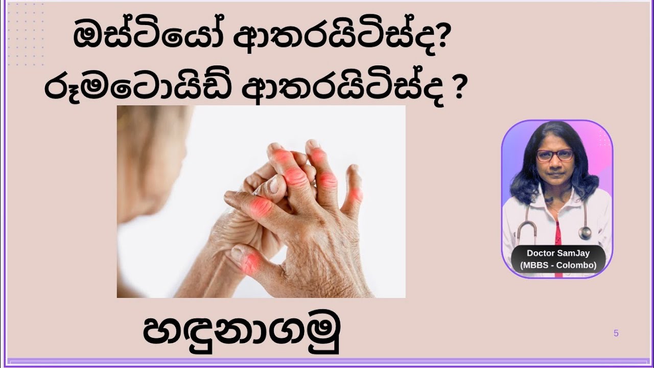 රූමටොයිඩ් ආතරයිටිස් සහ ඔස්ටියෝ ආතරයිටිස් #rheumatoidarthritis #osteoarthritis 