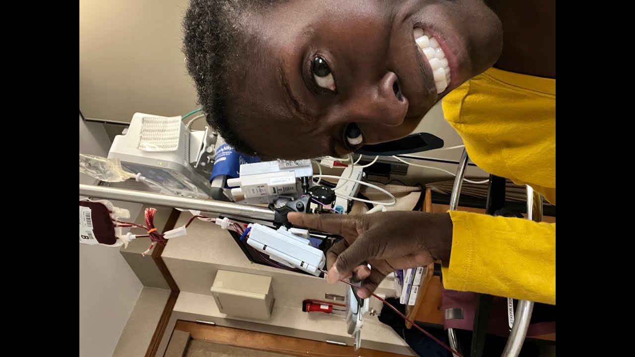 1 Week Post Stem Cell Transplant at Mayo Clinic