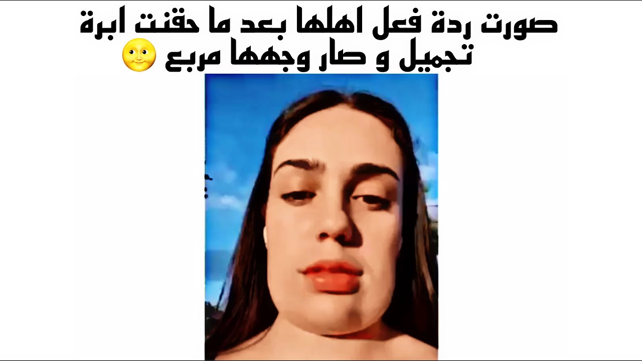 مقاطع انستقرام / صورت ردة فعل اهلها بعدما حقنت ابرة تجميل و صار و جهها مربع 🌝 اذا طلبت اكل و تاخر 😂