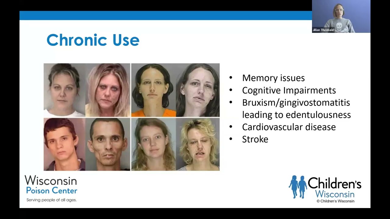 Sympathomimetics, anticholinergics