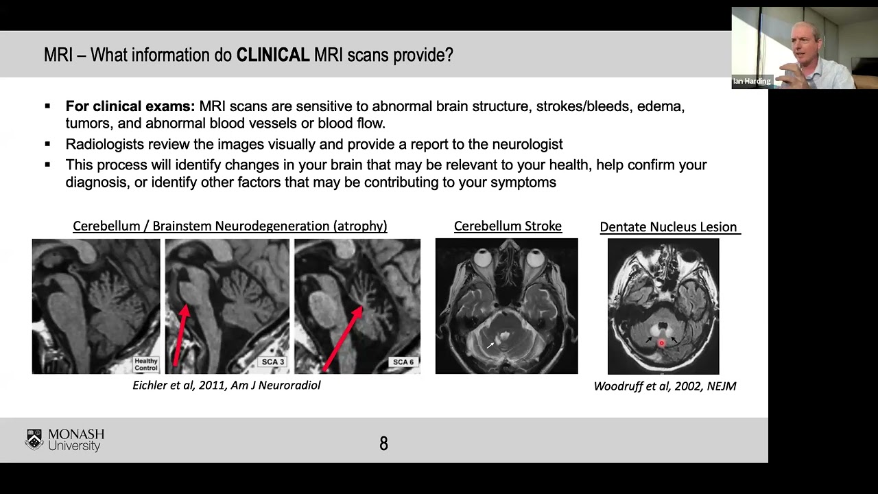 All About Imaging: CT, MRI, and PET | PrepRARE Video