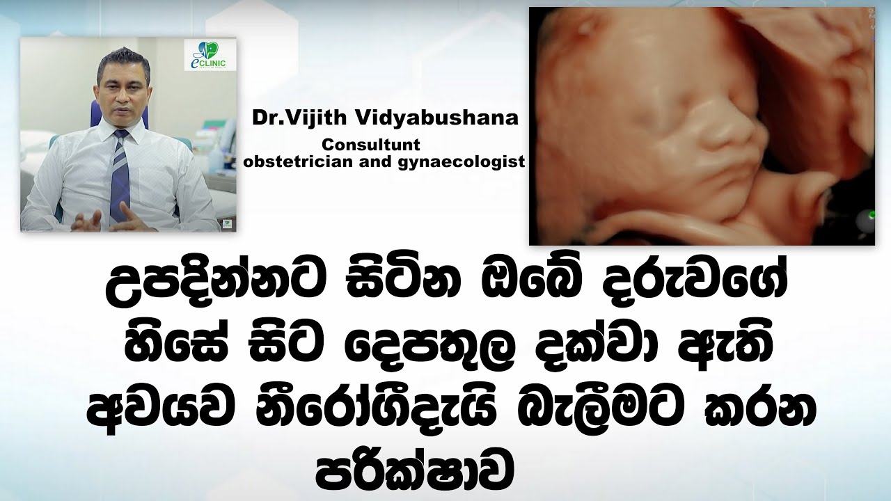උපදින්නට සිටින දරුවගේ හිසේ සිට දෙපතුල දක්වාඇති අවයව නීරෝගීදැයි බැලීමට කරන පරික්ෂාව #anomaly  scan