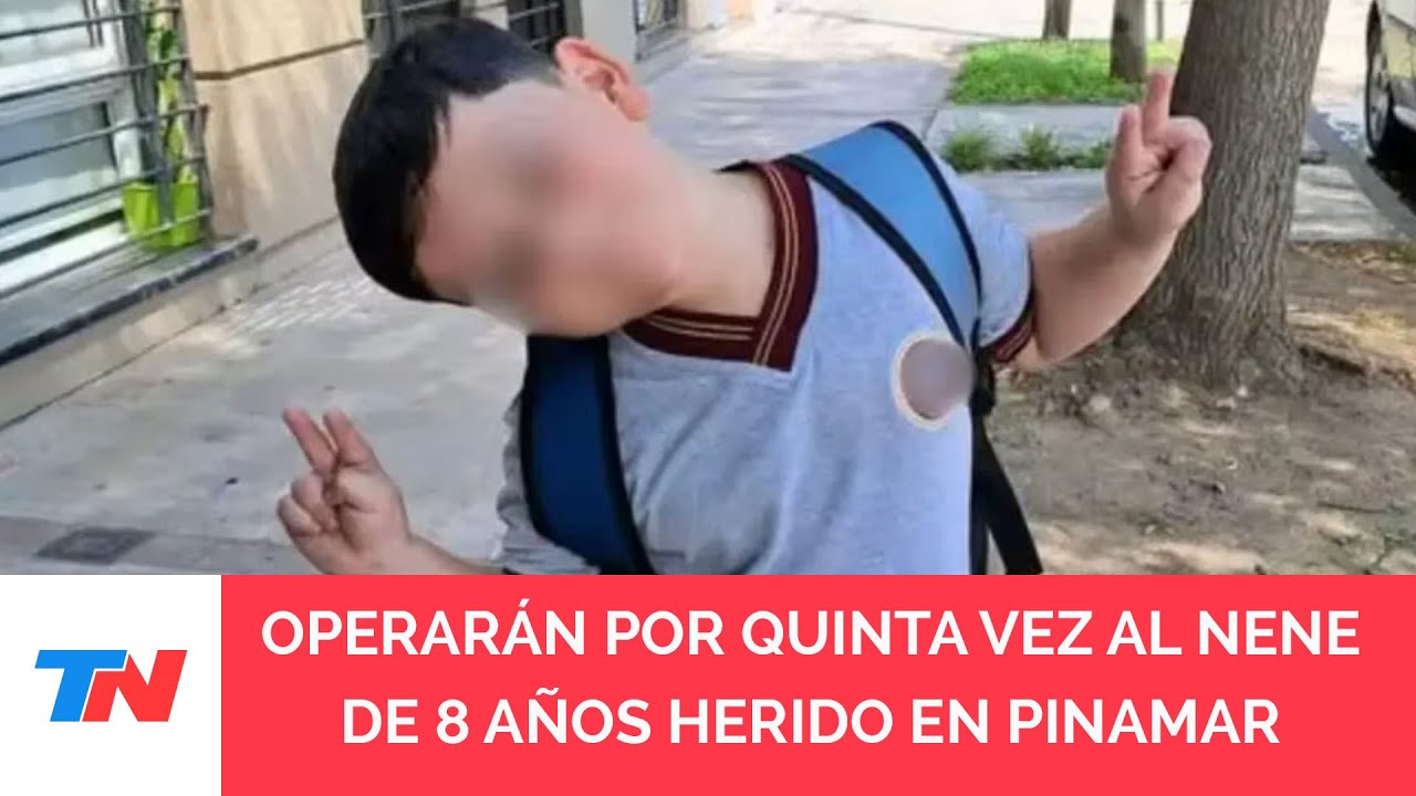 Volverán a operar a Bastian, el nene de 8 años que sufrió un grave accidente en Pinamar