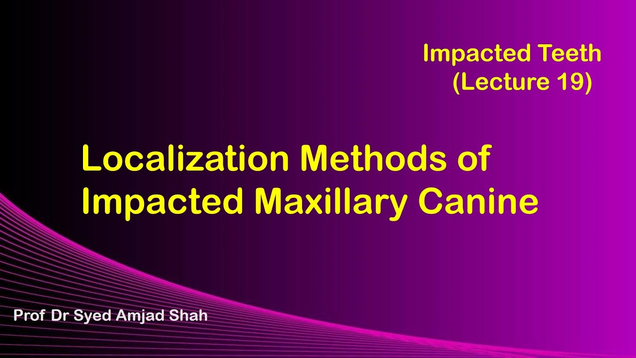 Localization Methods of Impacted Maxillary Canine | Oral & Maxillofacial Surgery | Syed Amjad Shah