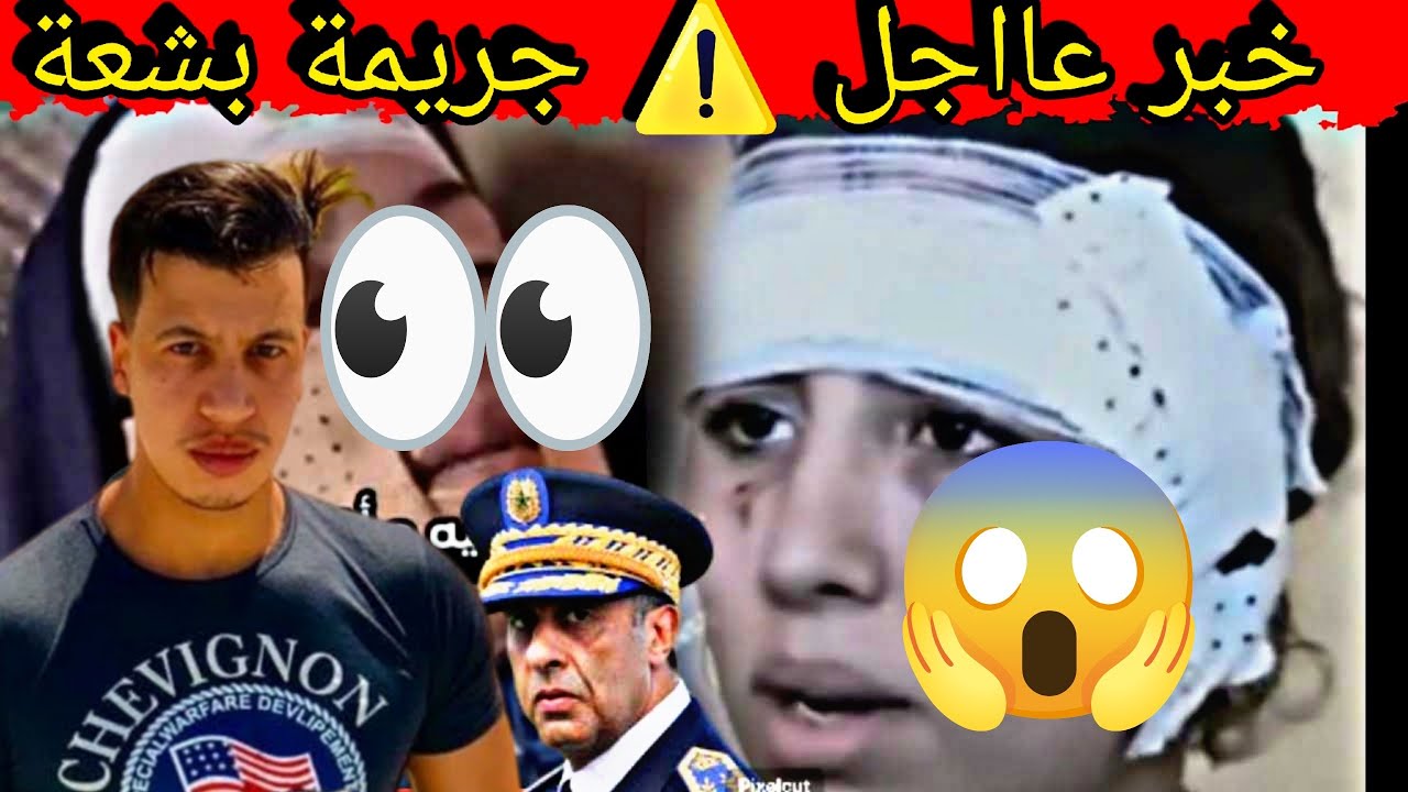 🤕⚔️ صعصع فوجهها بلعلالي وناس كتشوف👀ودار ليها 60 غرزة‼️وداها لغابة 🛤️ صافي ولات سيبة ‼️