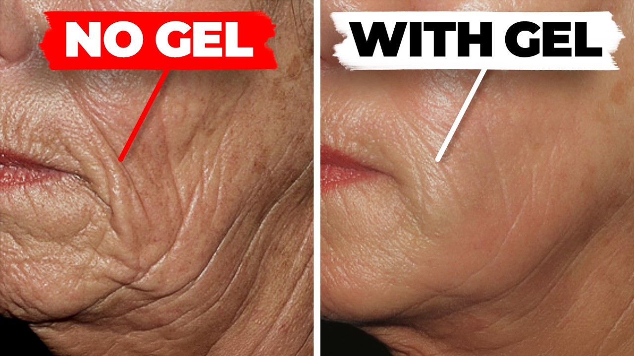 The World's #1 NIGHTLY Anti-Wrinkle Gel