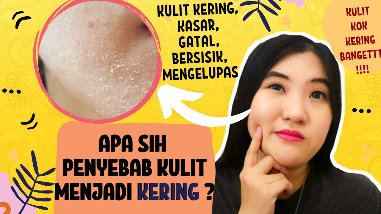 Apa Penyebab Kulit Menjadi Kering? - Kulit Kering, Kasar, Bersisik, Gatal, Mengelupas