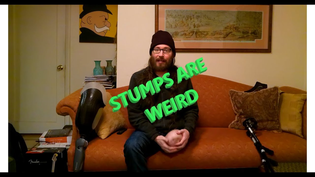 Flexing an Above Knee Stump is Weird!