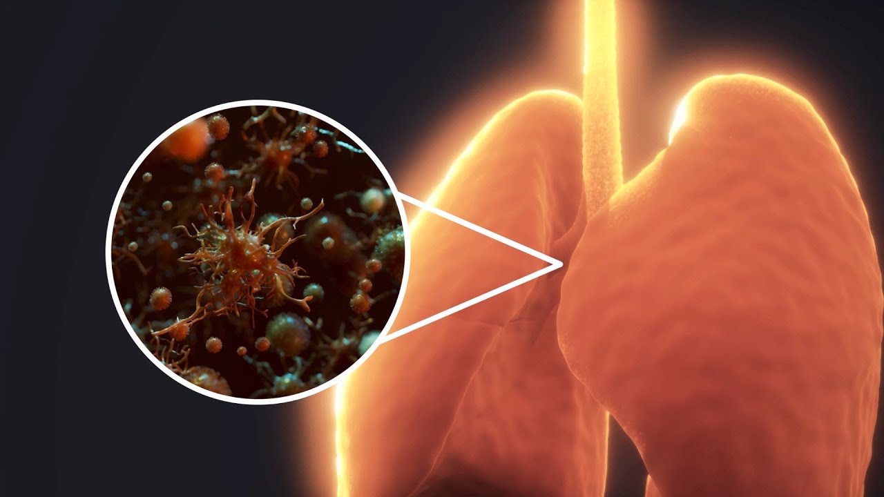 WORLD LUNG DAY 25th September | Love Your Lungs
