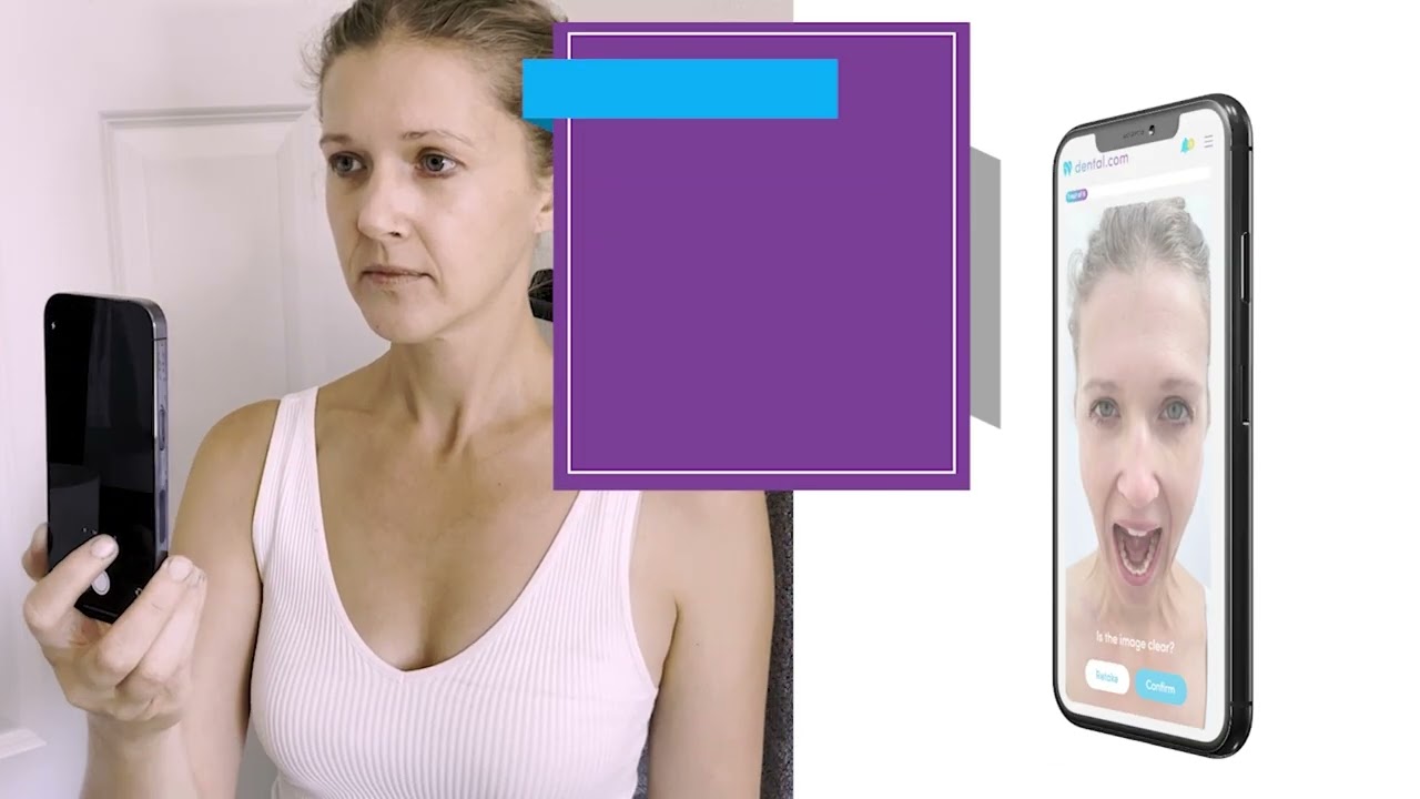 MetLife AI Dental Photo Assessments | Smart Scan by Dental.com