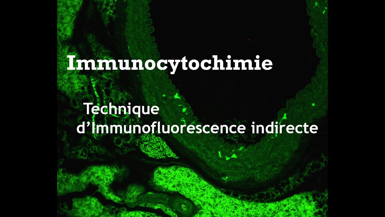 M&eacute;thode d'immunofluorescence indirecte