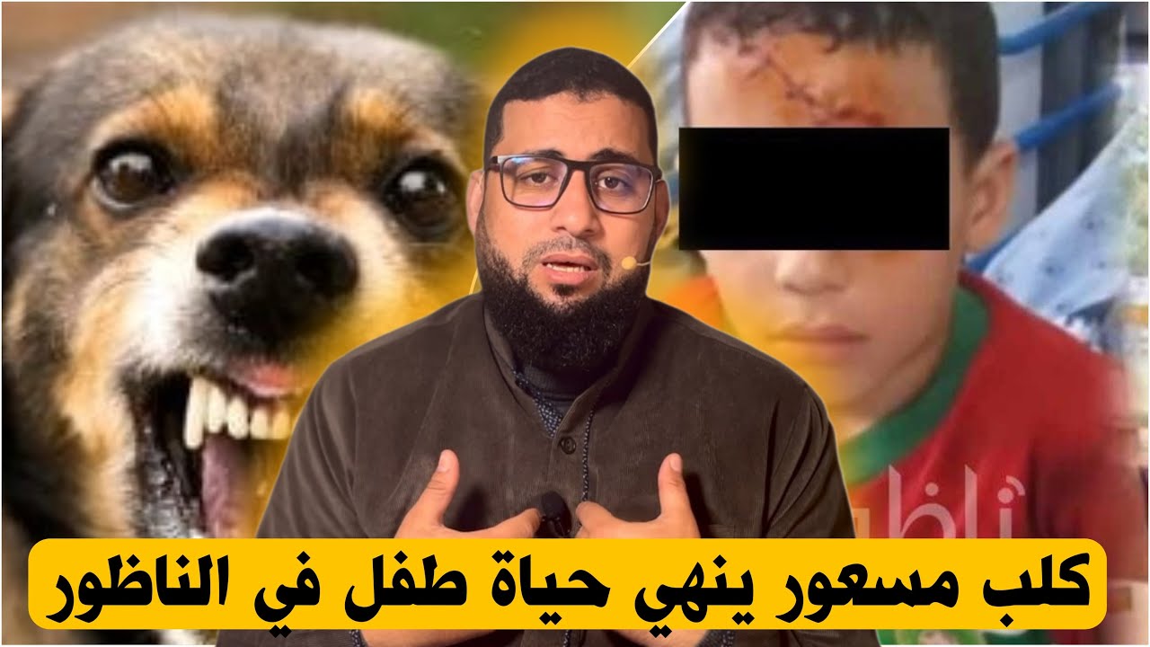 كلب مسعور  ينهي حياة طفل في الناظور