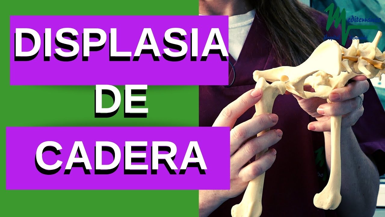 DISPLASIA DE CADERA EN PERROS/¡INFORMACIÓN MUY IMPORTANTE!