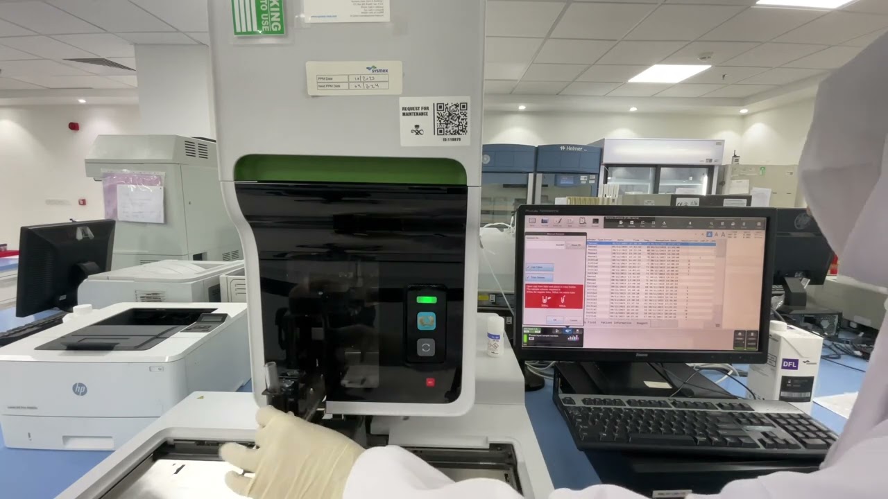 Sysmex XN1000 Body Fluid Cell Count