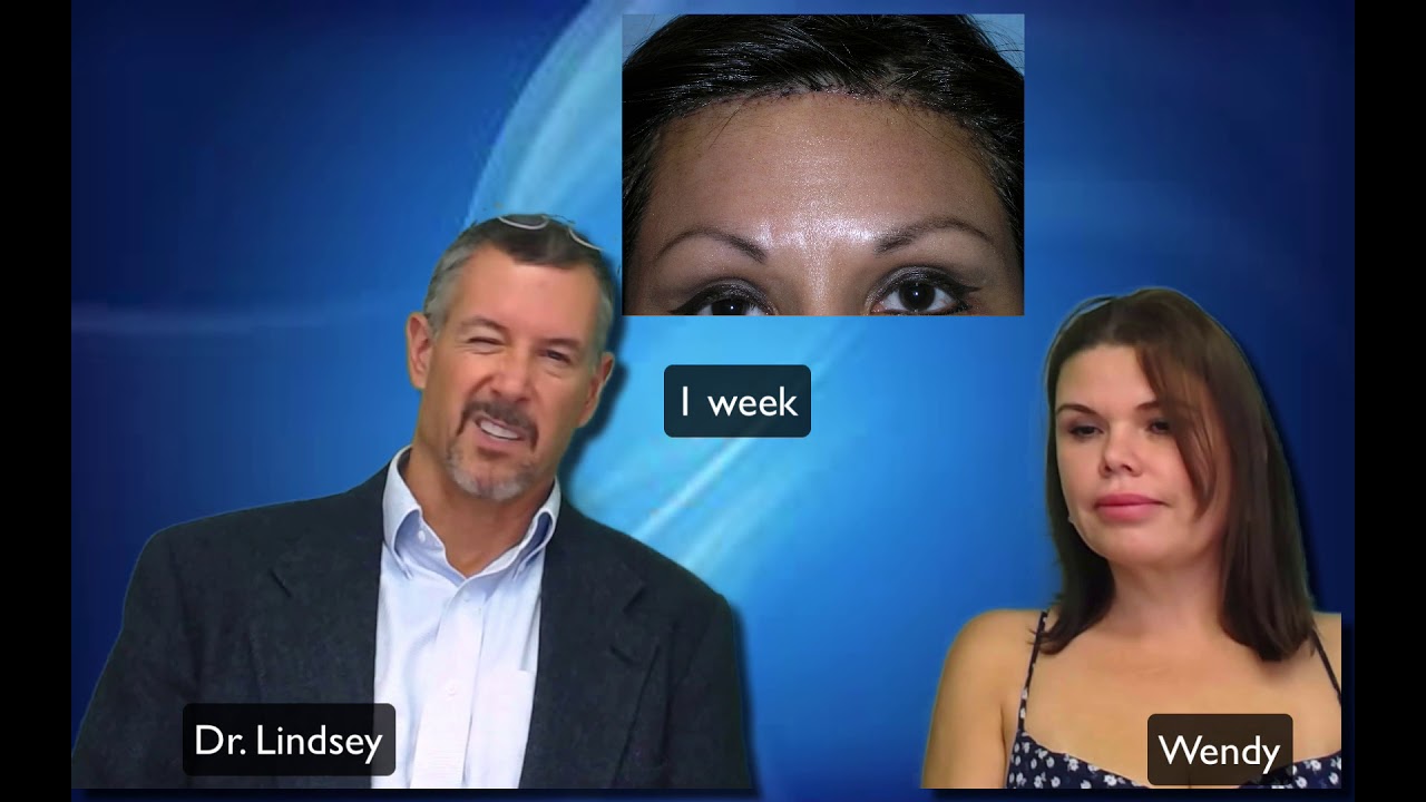 Trichophytic browlifting for the aging upper face by Dr. Lindsey | Washington | DC | Virginia