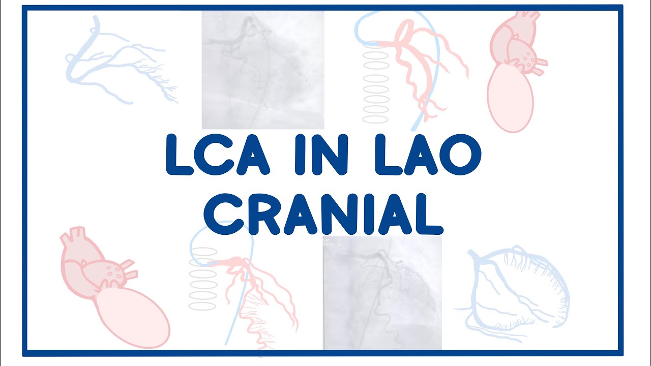 LAO Cranial - Left Coronary Artery