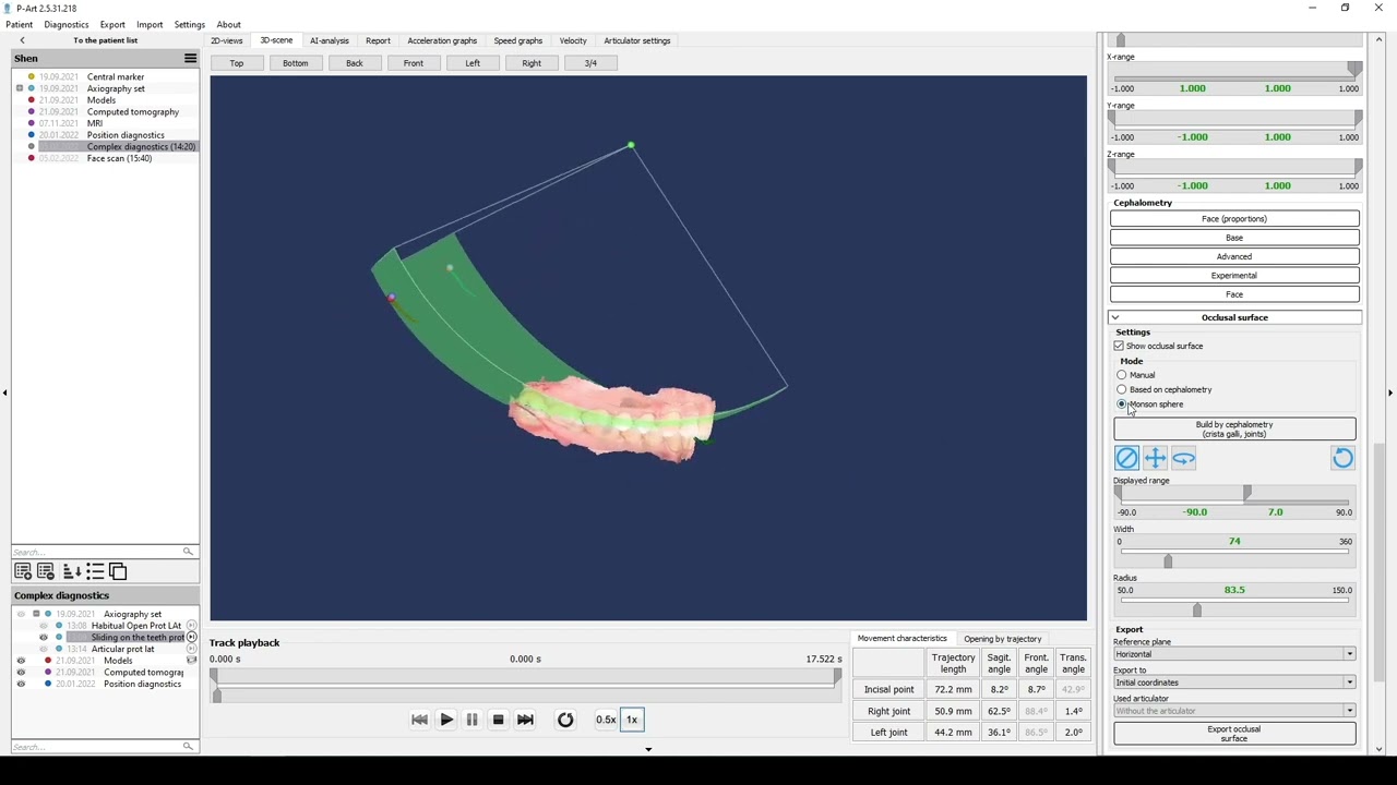 23. Export data to exocad