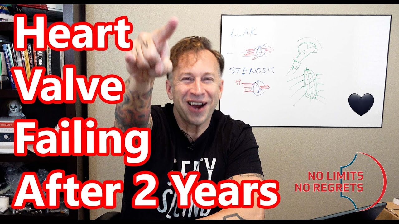My HYBRID HEART VALVE FAILURE at 2 Years