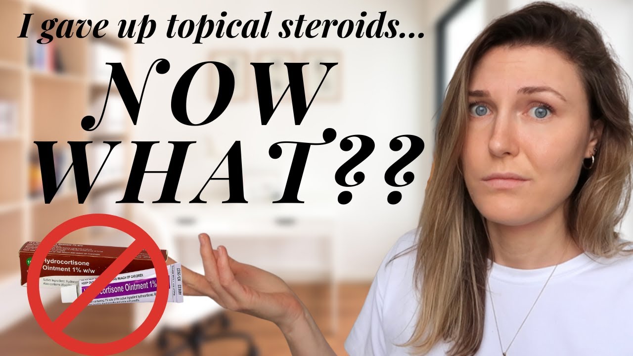Preparing to get off HYDROCORTISONE for eczema (10 BEST TIPS!) | Starting TSW