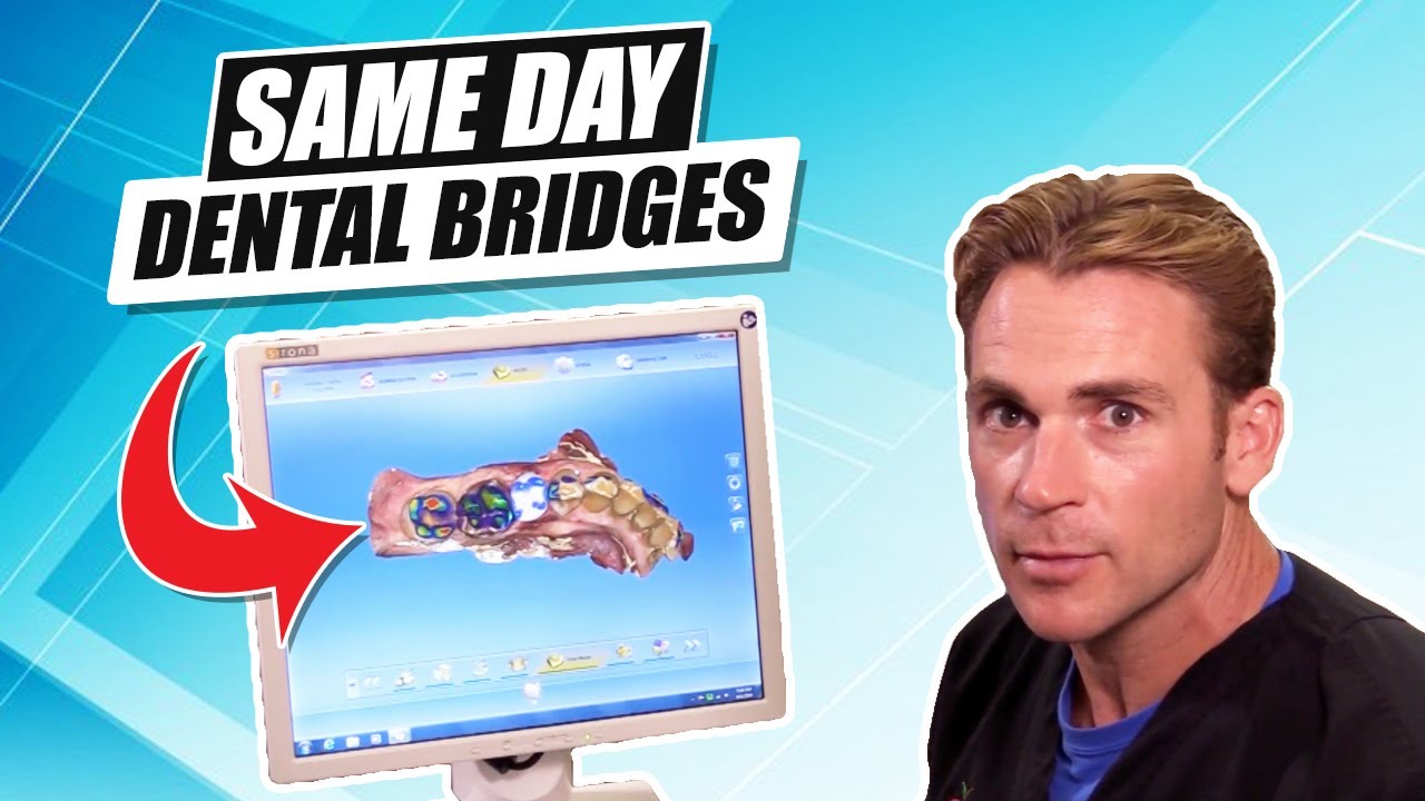 Cerec: The Technology That Makes Same Day Bridges Possible