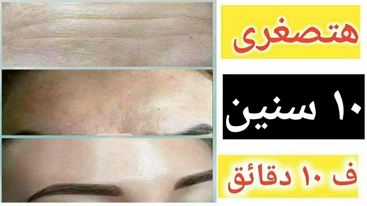 أقسمت لي الصيدلانية! بديل الريتينول بـ 40 جنيه اللي هيصغر سنك 10 سنين في أسبوع 😱