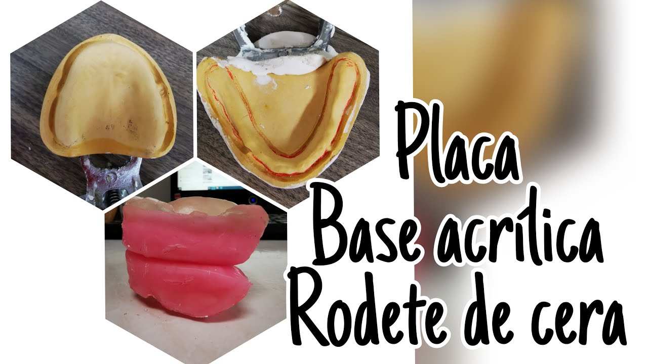 PLACA BASE ACRILICA Y RODETE DE CERA + DUPLICADO DE MODELO
