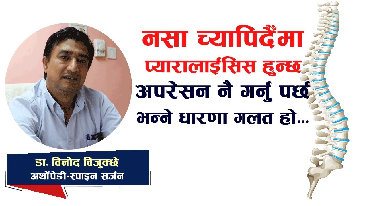 नसा च्यापिदैँमा प्यारालाईसिस हुन्छ, अपरेसन नै गर्नु पर्छ भन्ने धारणा गलत हो – डा. विनोद विजुक्छे