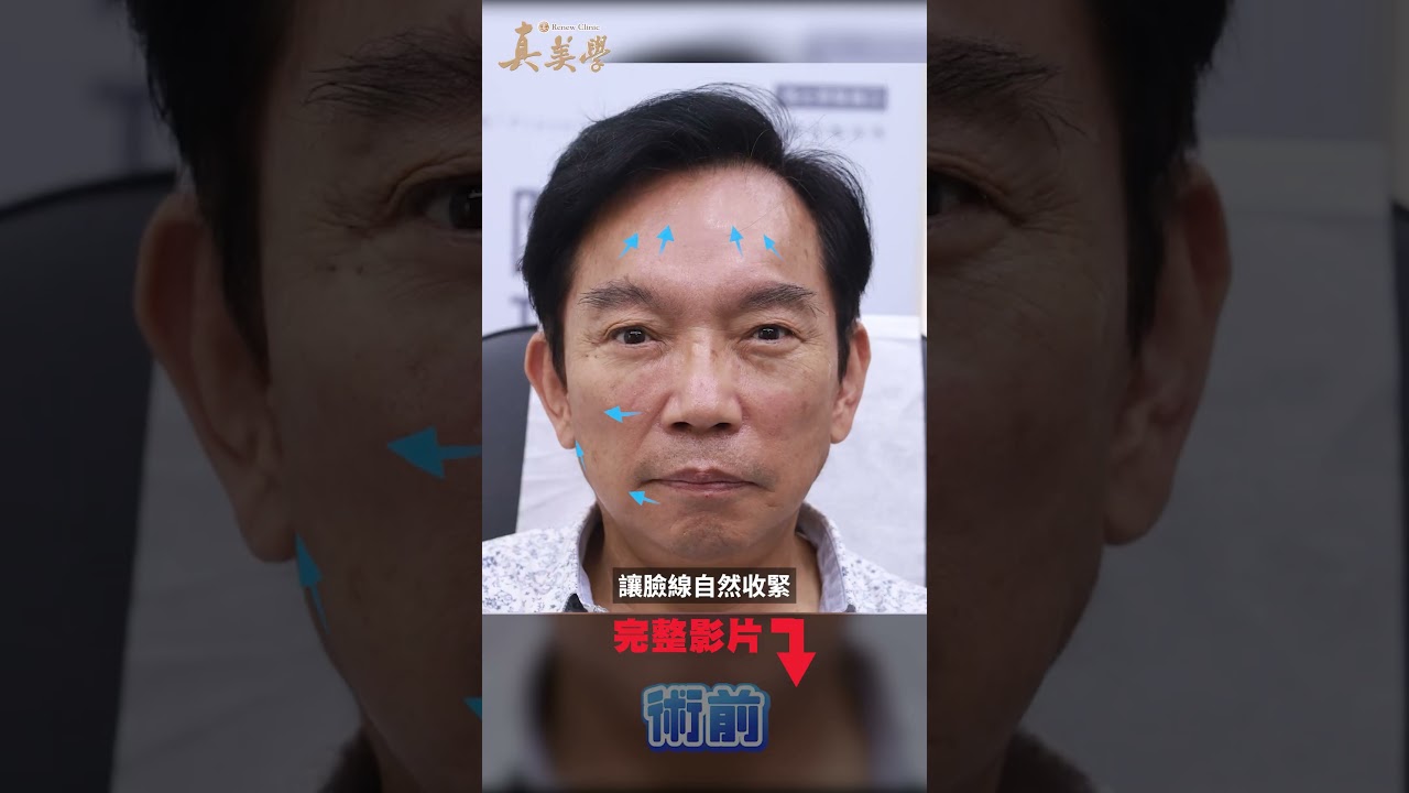 #抗老