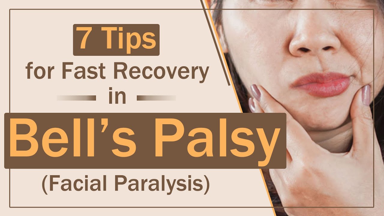 7 Tips for Fast Recovery in Bell's Palsy | Facial Paralysis जल्दि ठीक करने के 7 टिप्स