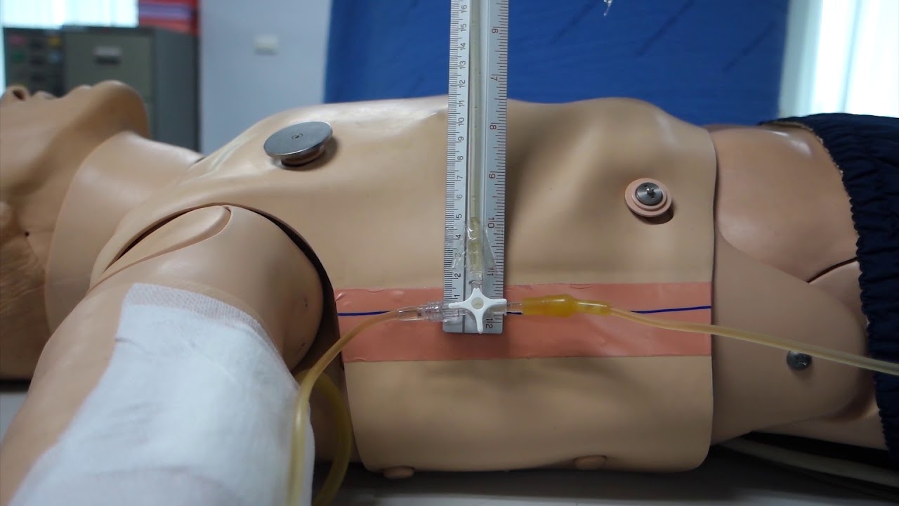 Measuring CVP