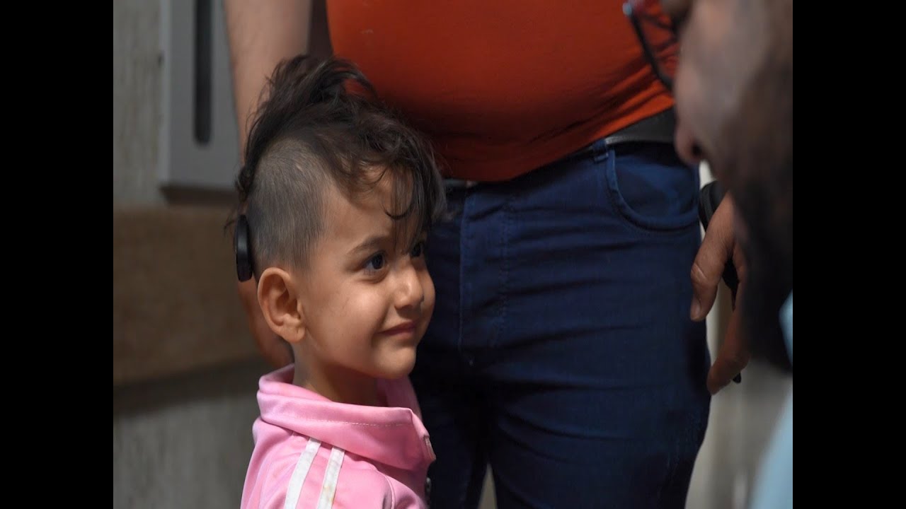 نجاح عملية زرع قوقعة الأذن لثلاثة أطفال في إدلب